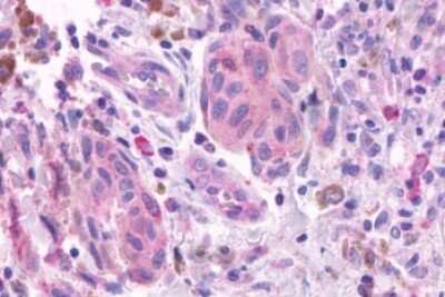 Immunohistochemistry-Paraffin: Olfactory Receptor OR2A4 Antibody - BSA Free [NLS3900]