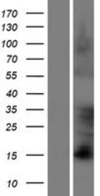 Western Blot: FAM83D Overexpression Lysate [NBP2-06164]