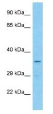 Western Blot: Olfactory Receptor OR7E24 Antibody [NBP3-09921]