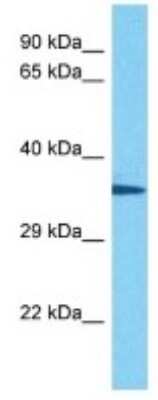 Western Blot: Olfactory receptor 139 Antibody [NBP3-10258]