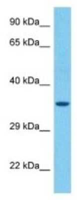 Western Blot: Olfactory receptor 142 Antibody [NBP3-10253]