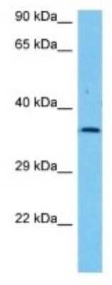 Western Blot: Olfactory receptor 181 Antibody [NBP3-10243]