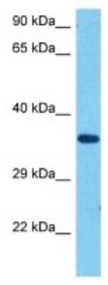 Western Blot: Olfactory receptor 470 Antibody [NBP3-10256]