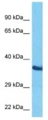 Western Blot: Olfactory receptor 472 Antibody [NBP3-10262]