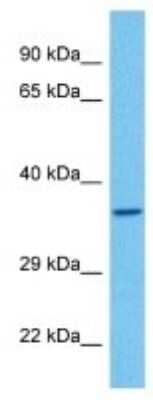 Western Blot: Olfactory receptor 474 Antibody [NBP3-10261]