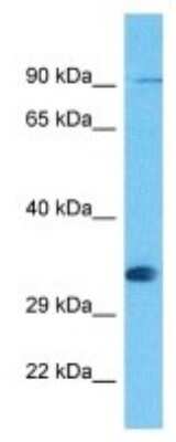 Western Blot: Olfactory receptor 476 Antibody [NBP3-10272]