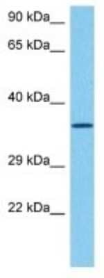 Western Blot: Olfactory receptor 478 Antibody [NBP3-10270]