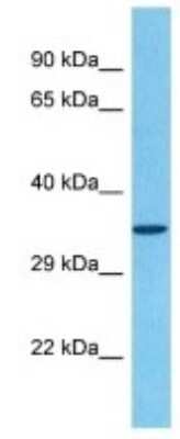 Western Blot: Olfactory receptor 481 Antibody [NBP3-10255]