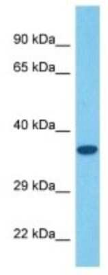 Western Blot: Olfactory receptor 484 Antibody [NBP3-10257]