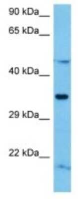 Western Blot: Olfactory receptor 488 Antibody [NBP3-10238]