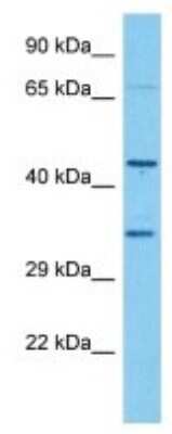 Western Blot: Olfactory receptor 490 Antibody [NBP3-10269]