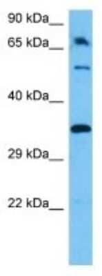 Western Blot: Olfactory receptor 491 Antibody [NBP3-10248]