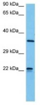 Western Blot: Olfactory receptor 510 Antibody [NBP3-10246]