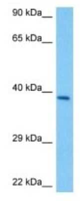 Western Blot: Olfactory receptor 867 Antibody [NBP3-10229]