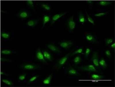 Immunocytochemistry/ Immunofluorescence: Olig1 Antibody (2B11) [H00116448-M04]