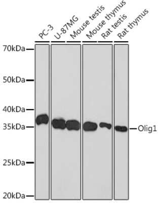 Western Blot: Olig1 Antibody (7E4B2) [NBP3-15326]