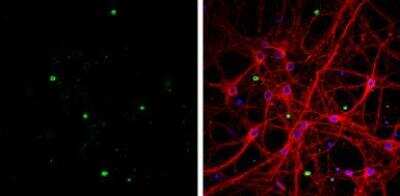 Immunocytochemistry/ Immunofluorescence: Olig1 Antibody [NBP1-31018]