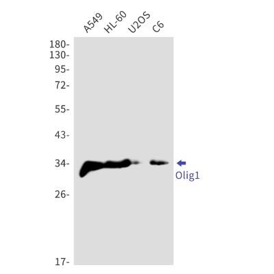 Western Blot: Olig1 Antibody (S07-1H5) [NBP3-19899]