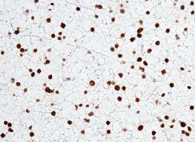 Immunohistochemistry-Paraffin: Olig2 Antibody (064) [NBP2-89201]