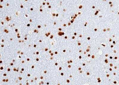 Immunohistochemistry-Paraffin: Olig2 Antibody (064) [NBP2-89201]