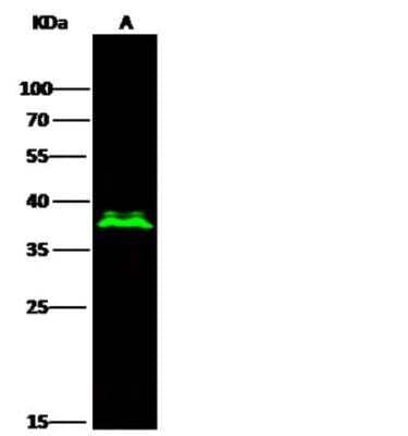 Western Blot: Olig2 Antibody (064) [NBP2-89201]