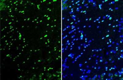 Immunohistochemistry-Frozen: Olig2 Antibody (HL1072) [NBP3-13712]
