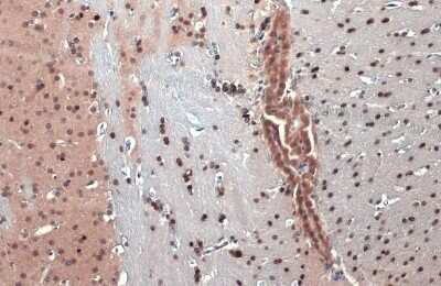 Immunohistochemistry-Paraffin: Olig2 Antibody (HL1072) [NBP3-13712]