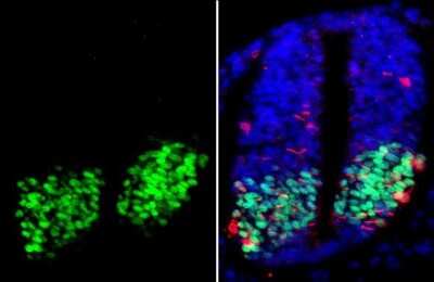 Immunohistochemistry-Paraffin: Olig2 Antibody (HL1072) [NBP3-13712]