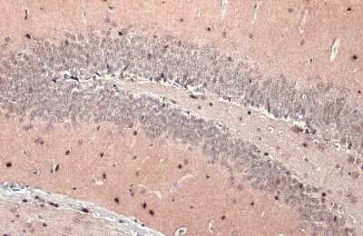 Immunohistochemistry-Paraffin: Olig2 Antibody (HL1072) [NBP3-13712]