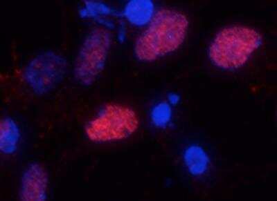 Immunocytochemistry/ Immunofluorescence: Olig2 Antibody - Azide and BSA Free [NBP1-28667]