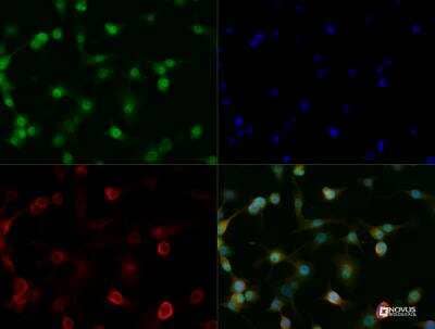 Immunocytochemistry/ Immunofluorescence: Olig2 Antibody [NBP2-27301]