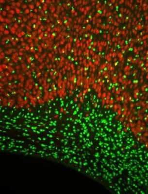 Immunohistochemistry: Olig2 Antibody - Azide and BSA Free [NBP1-28667]