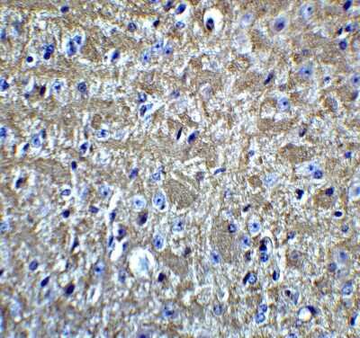 Immunohistochemistry: Olig2 Antibody - BSA Free [NBP2-41269]