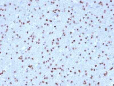 Immunohistochemistry-Paraffin: Olig2 Antibody (OLIG2/2400) [NBP3-07214]