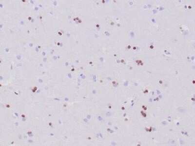 Immunohistochemistry-Paraffin: Olig2 Antibody (OLIG2/6695R) [NBP3-13830]