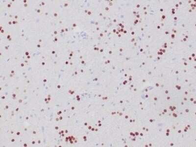 Immunohistochemistry-Paraffin: Olig2 Antibody (OLIG2/6695R) [NBP3-13830]