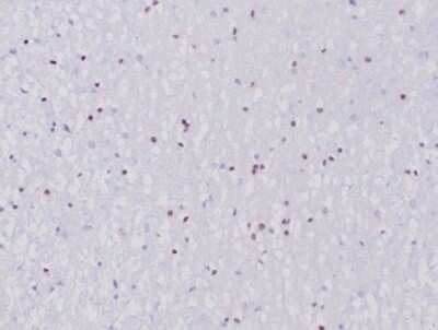 Immunohistochemistry-Paraffin: Olig2 Antibody (OLIG2/6695R) [NBP3-13830]