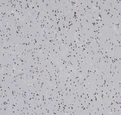 Immunohistochemistry-Paraffin: Olig2 Antibody (OLIG2/6695R) [NBP3-13830]