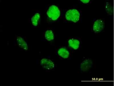 Immunocytochemistry/ Immunofluorescence: Olig3 Antibody [H00167826-B01P]