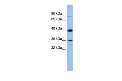 Western Blot: Olig3 Antibody [NBP2-87983]