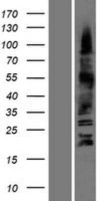 Western Blot: Olig3 Overexpression Lysate [NBP2-05055]