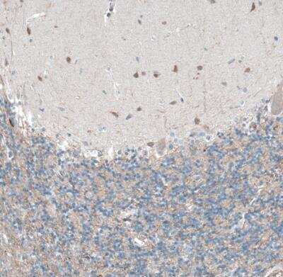 Immunohistochemistry-Paraffin: Oncomodulin Antibody [NBP2-14568]