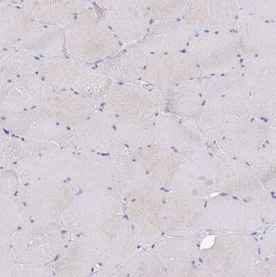 Immunohistochemistry-Paraffin: Oncomodulin Antibody [NBP2-14568]