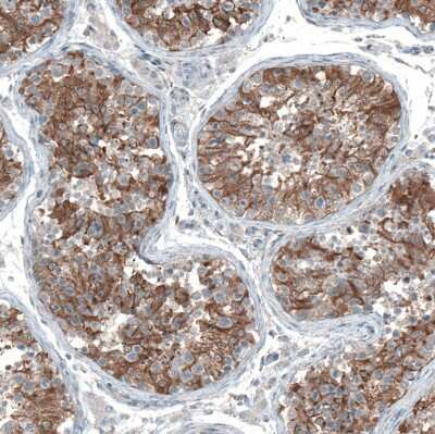 Immunohistochemistry-Paraffin: Oncomodulin Antibody [NBP2-14568]