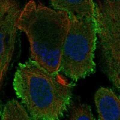 Immunocytochemistry/ Immunofluorescence: Oncomodulin/OCM2 Antibody [NBP3-17610]