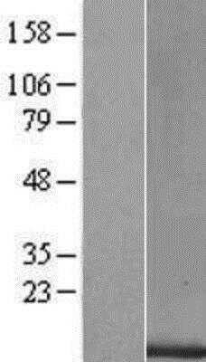 Western Blot: Oncomodulin/OCM2 Overexpression Lysate [NBP2-10425]