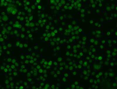 Immunocytochemistry/ Immunofluorescence: Oncostatin M/OSM Antibody (015) [NBP2-89506]