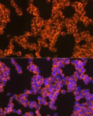 Immunocytochemistry/ Immunofluorescence: Oncostatin M/OSM Antibody (8O8K9) [NBP3-16686]