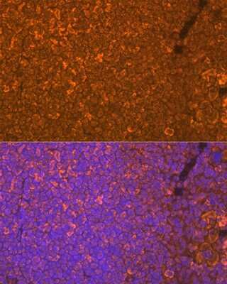 Immunohistochemistry: Oncostatin M/OSM Antibody (8O8K9) [NBP3-16686]