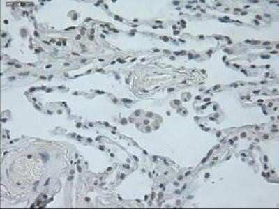 Immunohistochemistry: Oncostatin M/OSM Antibody (OTI2B6) - Azide and BSA Free [NBP2-73146]